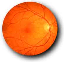 normal retina
