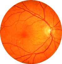 normal retina