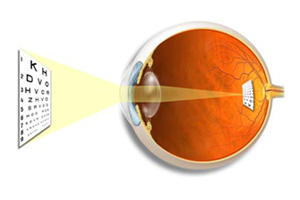 Common Eye Conditions thumbnail